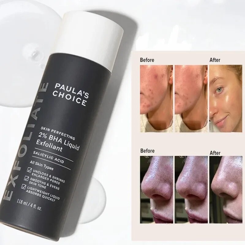 Paula's Choice Skin Perfecting 2% BHA Liquid Exfoliant